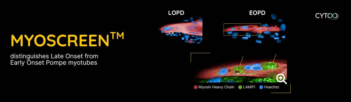 MyoScreen platform, pompe disease
