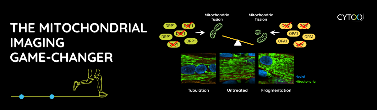 visualize and quantify mitochondrial structure