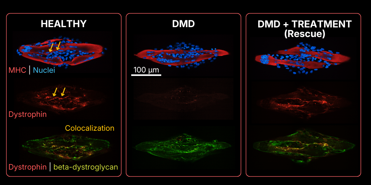 DMD disease modeling - CYTOO