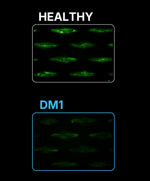 DM1 CYTOO
